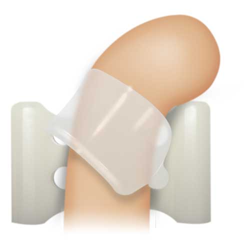 和*紙様 Andropenis Gold Andropenis - Safe Penis Extender